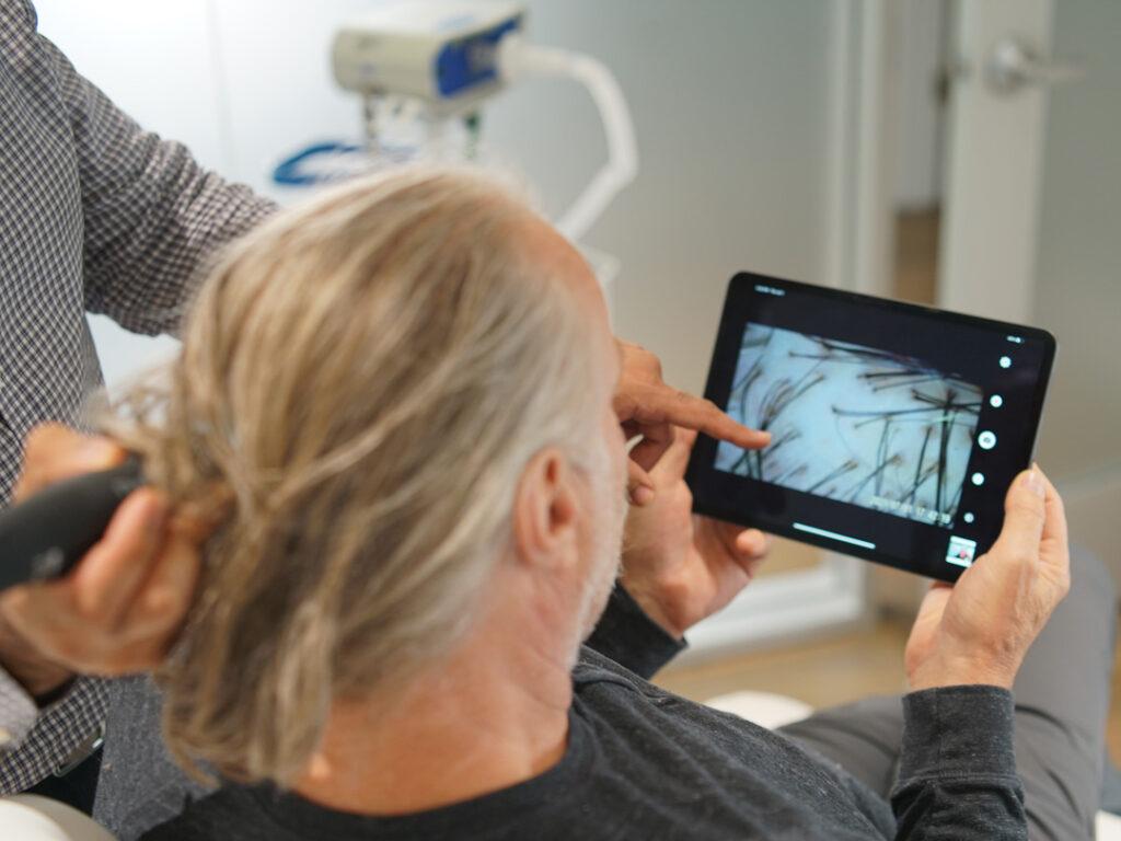 Los mejores doctores de trasplante de cabello en Chicago