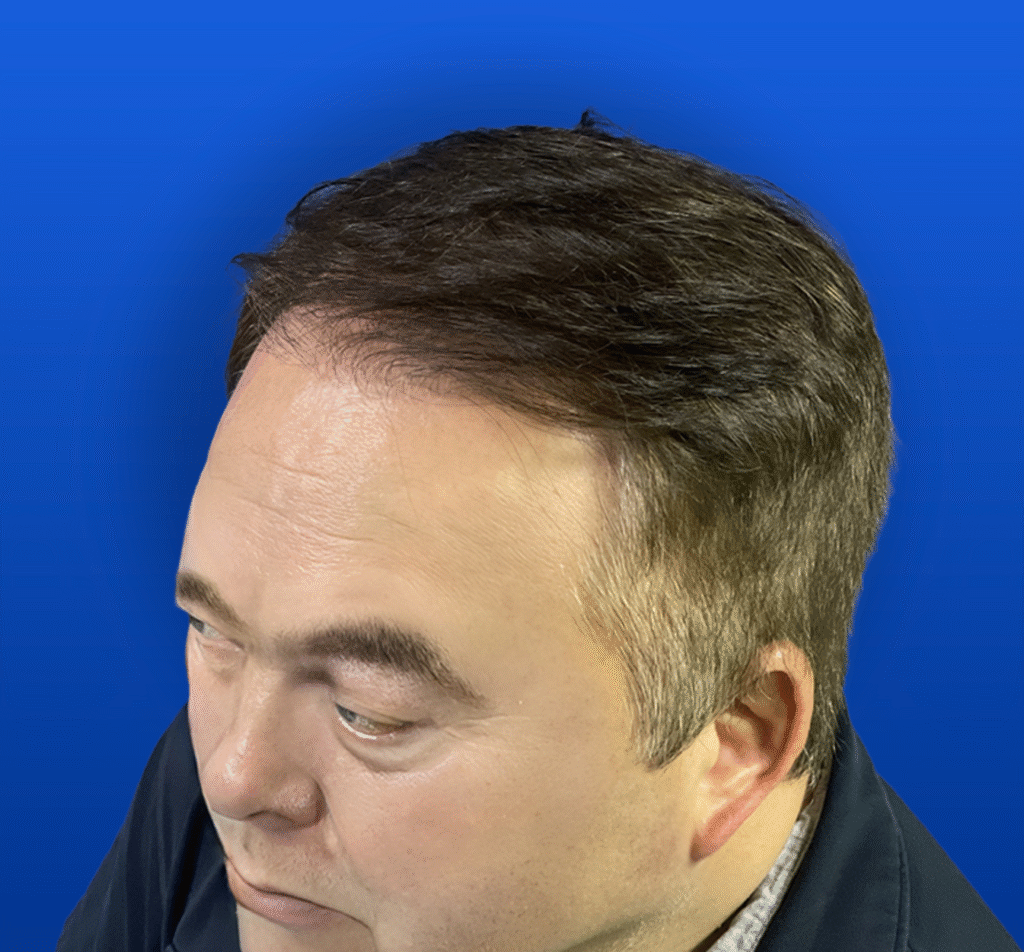 1-1 A