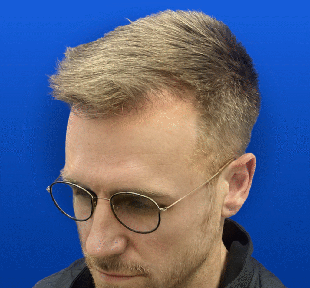 1-1 A