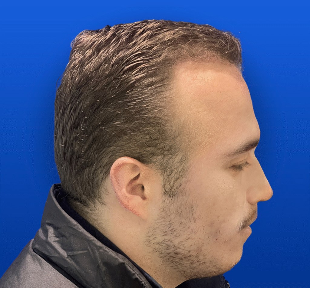 1-3 A
