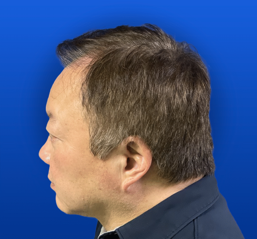 1-3 A