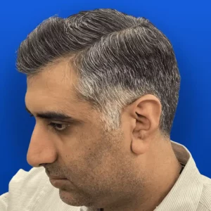 8.1-A